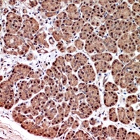 Serpin A3 Rabbit Polyclonal Antibody