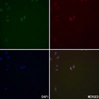 Serpin A3 Rabbit Polyclonal Antibody