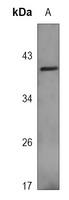 CD7 Rabbit Polyclonal Antibody