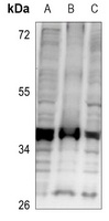 CD74 Rabbit Polyclonal Antibody