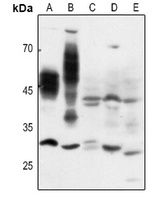 CD147 Rabbit Polyclonal Antibody