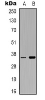 CD321 Rabbit Polyclonal Antibody