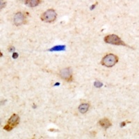 EDG5 Rabbit Polyclonal Antibody