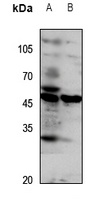 GPR172A Rabbit Polyclonal Antibody