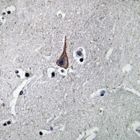 EGF Rabbit Polyclonal Antibody