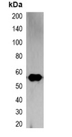 RFP-tag Mouse Monoclonal Antibody