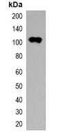 Trx-tag Mouse Monoclonal Antibody