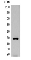 EYFP-tag Rabbit Polyclonal Antibody