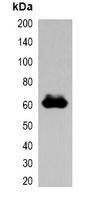 FLAG-tag Rabbit Polyclonal Antibody