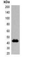 GST-tag Rabbit Polyclonal Antibody