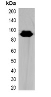 HA-tag Rabbit Polyclonal Antibody