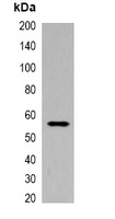 His-tag Rabbit Polyclonal Antibody