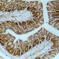 AMPK alpha 1 Mouse Monoclonal Antibody