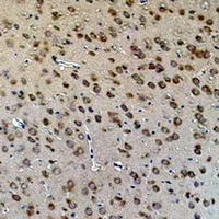 Aquaporin 4 Mouse Monoclonal Antibody