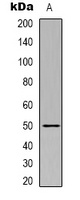 Beta1-tubulin Mouse Monoclonal Antibody
