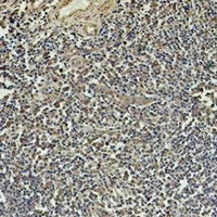 Beta1-tubulin Mouse Monoclonal Antibody