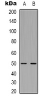 Beta2A-tubulin Mouse Monoclonal Antibody