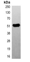 Beta2A-tubulin Mouse Monoclonal Antibody