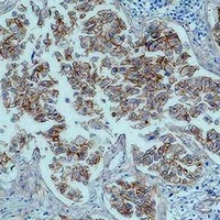 Beta-catenin Mouse Monoclonal Antibody