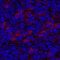 Beta-catenin Mouse Monoclonal Antibody