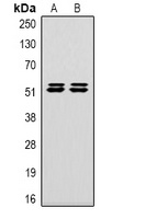 Carbonic Anhydrase 9 Mouse Monoclonal Antibody