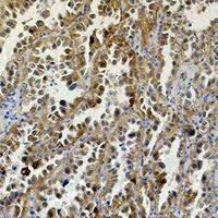 Carbonic Anhydrase 9 Mouse Monoclonal Antibody