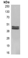 Carbonic Anhydrase 9 Mouse Monoclonal Antibody