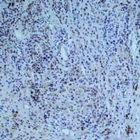 Collagen 3 alpha 1 Antibody