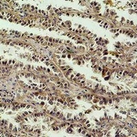 CREB Mouse Monoclonal Antibody