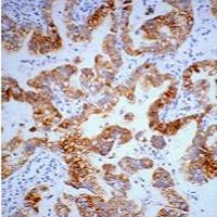 Cytokeratin 7 Mouse Monoclonal Antibody