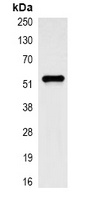 Cytokeratin 7 Mouse Monoclonal Antibody