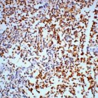 Gamma-enolase Mouse Monoclonal Antibody