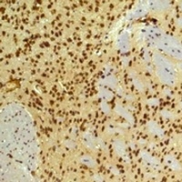 HIF1 beta Mouse Monoclonal Antibody