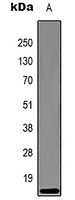 Histone H3 (DiMethyl-K27) Antibody