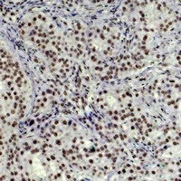 Histone H3 (TriMethyl-K79) Antibody