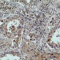 MICU1 Mouse Monoclonal Antibody