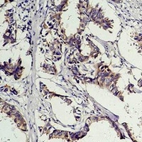 Phosphotyrosine Mouse Monoclonal Antibody