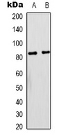 PI3K p85 alpha Mouse Monoclonal Antibody
