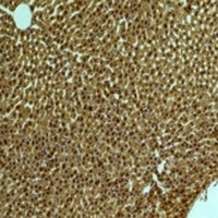 PI3K p85 alpha Mouse Monoclonal Antibody