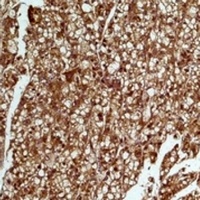 SMAD3 Mouse Monoclonal Antibody