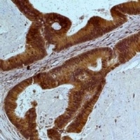 STAT3 Mouse Monoclonal Antibody