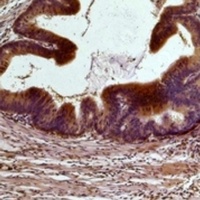 STAT3 Mouse Monoclonal Antibody