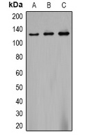 CACNA2D2 Rabbit Polyclonal Antibody