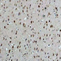 Calcium Sensing Receptor Rabbit Polyclonal Antibody