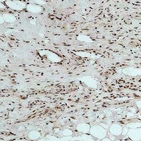 CALHM1 Rabbit Polyclonal Antibody