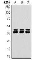 DUSP6 Rabbit Polyclonal Antibody