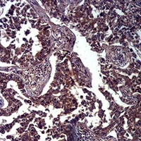 E Cadherin Rabbit Polyclonal Antibody