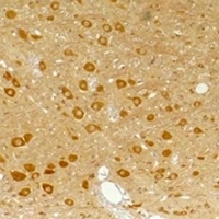 GABRA3 Rabbit Polyclonal Antibody