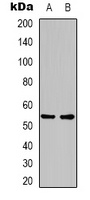 GLP-1 Receptor Rabbit Polyclonal Antibody