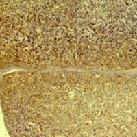 GLP-1 Receptor Rabbit Polyclonal Antibody